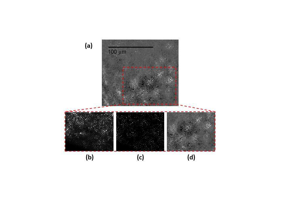 Figure 3 – ARPE cells image taken using our SMFB and post-processing. The image after scanning and post-processing is shown in (a) and a magnification of the red dashed rectangle is shown both to a single raw image (b), the same image after cores intensities extraction and flat-correction (c) and the magnified area after final image processing where the ARPE cell is now resolved (d).